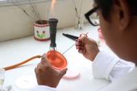 Varias epidemias han alcanzado a la Pen&iacute;nsula de Yucat&aacute;n