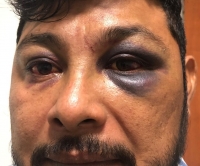 Polic&iacute;as de Chicxulub Pueblo torturan y amenazan a ciudadano