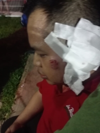 Perro arranca oreja a su due&ntilde;o