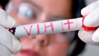 Piden redoblar esfuerzos contra el VIH