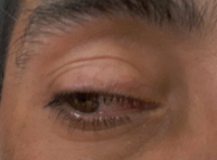 Conjuntivitis no da tregua