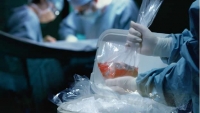 Órganos no se deben enterrar, sino donar: académico