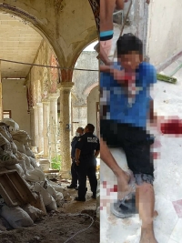 Alba&ntilde;il de 17 a&ntilde;os sufre serias lesiones