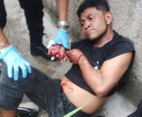 Atacan a hombre en Kanasín