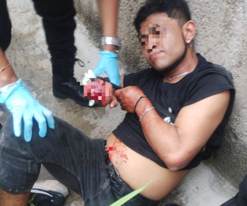 Atacan a hombre en Kanasín